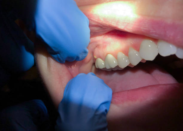 Best Pediatric Emergency Dentist in Seward, NE