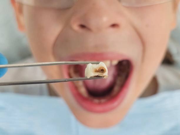 Best Cosmetic Emergency Dentistry in Seward, NE